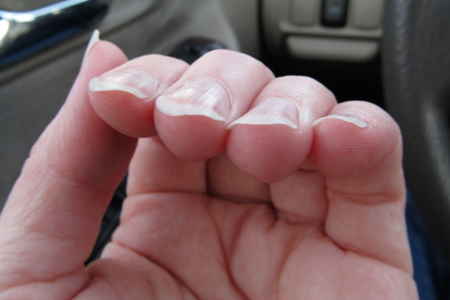 Почему ногти скручиваются под гель лаком - красота и здоровье