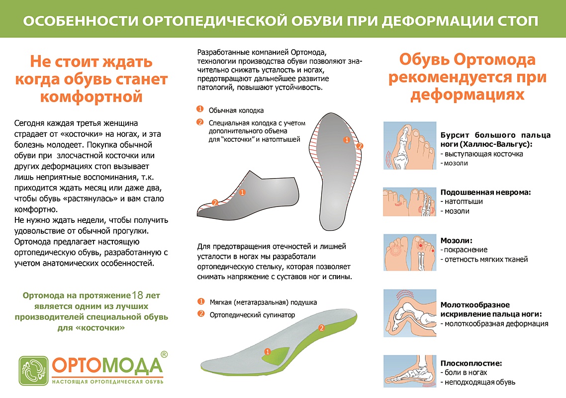 Можно вернуть обувь если натирает. Правильная обувь для стопы. Ортопедическая обувь характеристики. Ношение ортопедической обуви. Ортопедическую обувь для больных ног.
