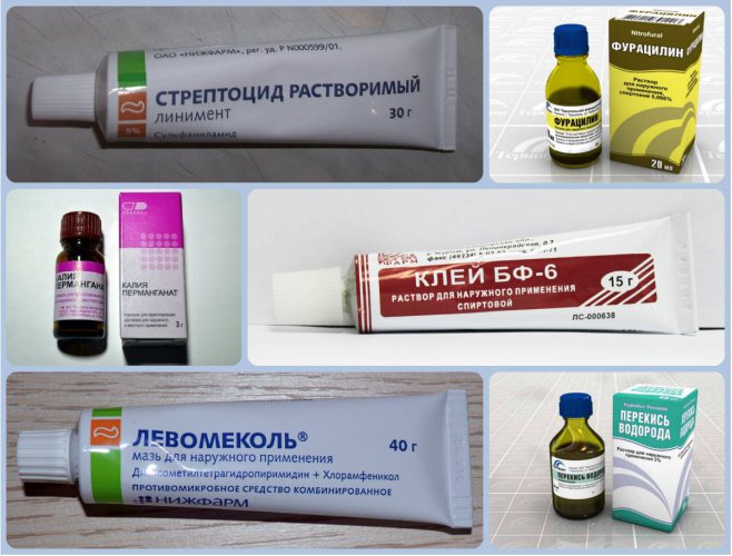 Как избавиться от шишек на ногах, пальце и пятке