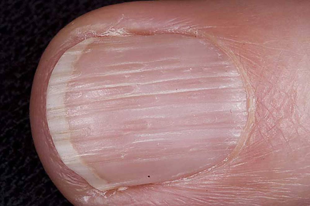 Как называются врачи по ногтям на пальцах рук и ног: какие доктора лечат вросшие пластины, грибок, иные проблемы, и названия специалистов, к которым нужно обращаться