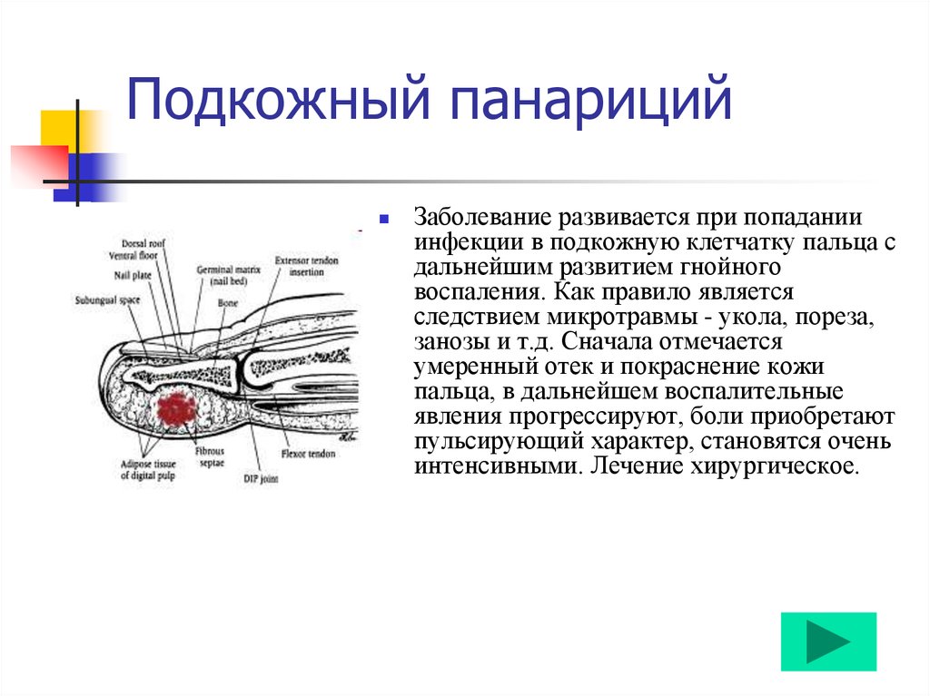 Заусенцы на пальцах
