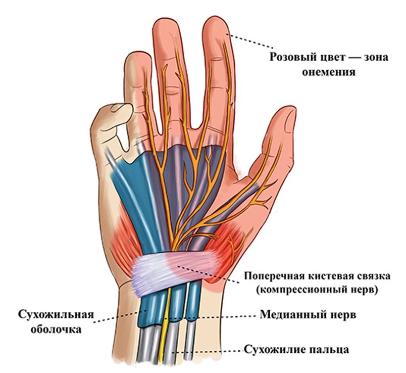 Онемение пальцев левой руки