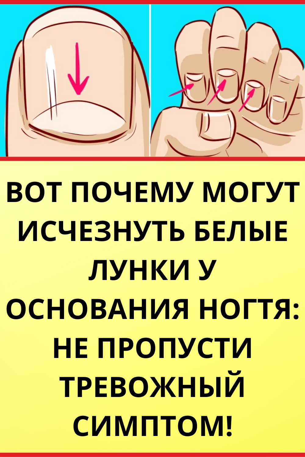 Диагностика здоровья по ногтям пальцев рук фото и описание