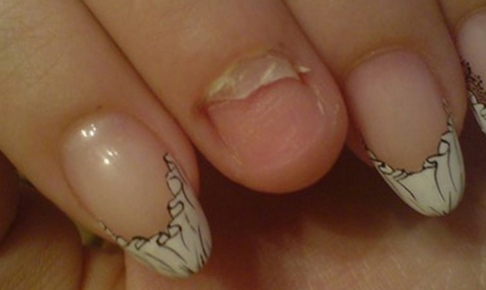 Трескается гель-лак на ногтях: причины почему лопается через неделю – как спасти