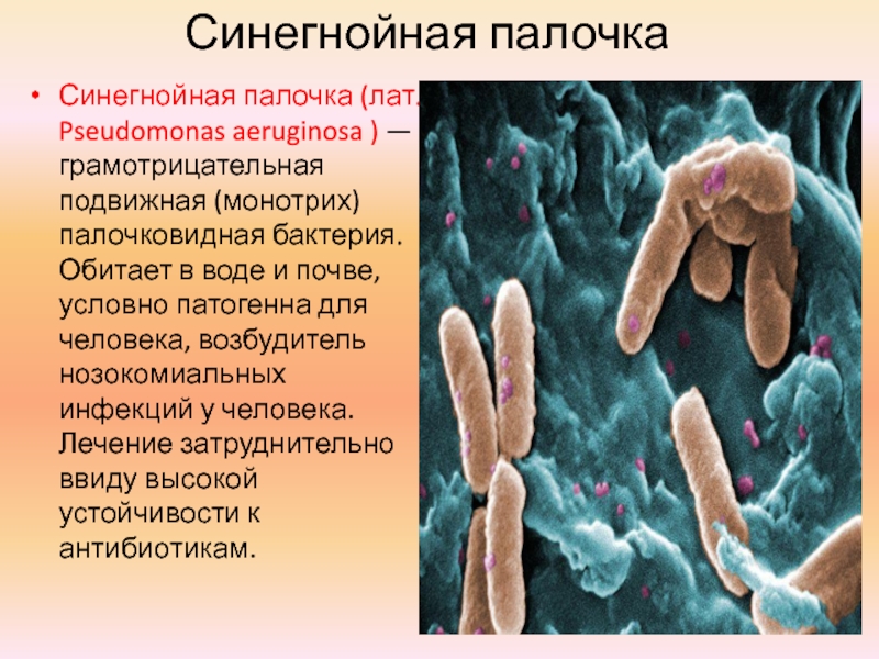 Бактерия синегнойная палочка. Pseudomonas aeruginosa (синегнойная палочка). Синегнойная палочка пиоцинотипирование. Синегнойная палочка заболевания микробиология. Бактерия псевдомонас аэругиноза что это.