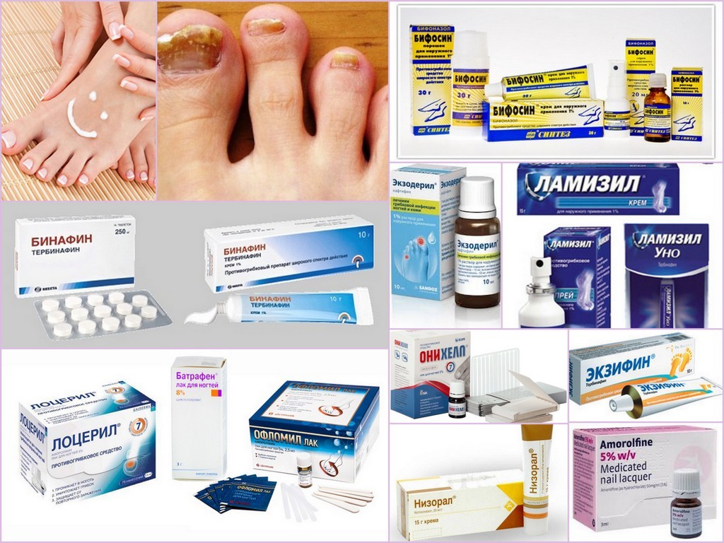 Онихомикоз (грибок ногтей). причины, симптомы, признаки, диагностика и лечение патологии :: polismed.com