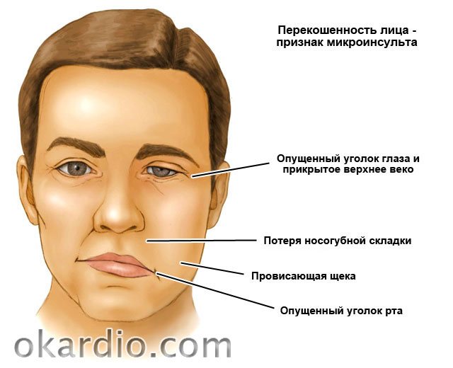 Псориаз на лице - как лечить, причины и симптомы заболевания