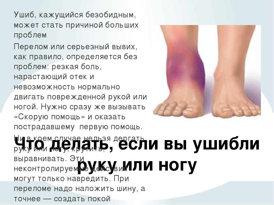 Заболевания сосудов ног. удаление сосудистых звездочек, лечение синяков на ногах.