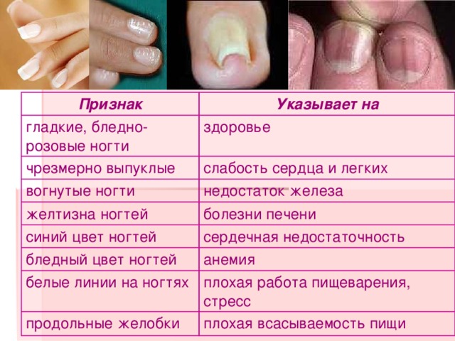 Болезни ногтей на ногах таблица и лечение у мужчин фото