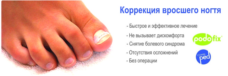 Вскрытие панариция