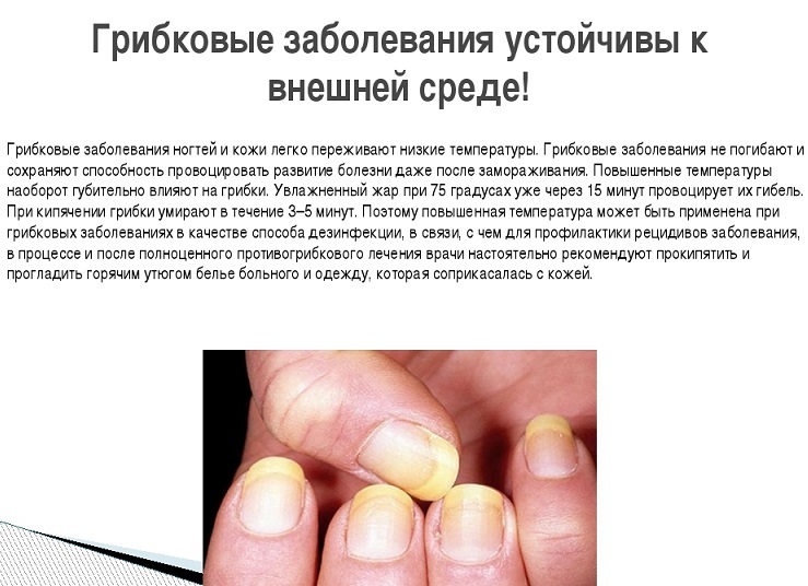 Устраняем псориаз ногтей: лечение в домашних условиях