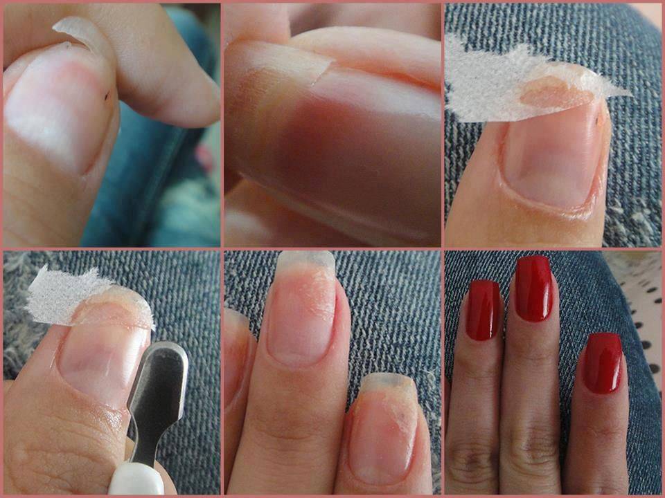 Как исправить трещину на ногте: 10 шагов