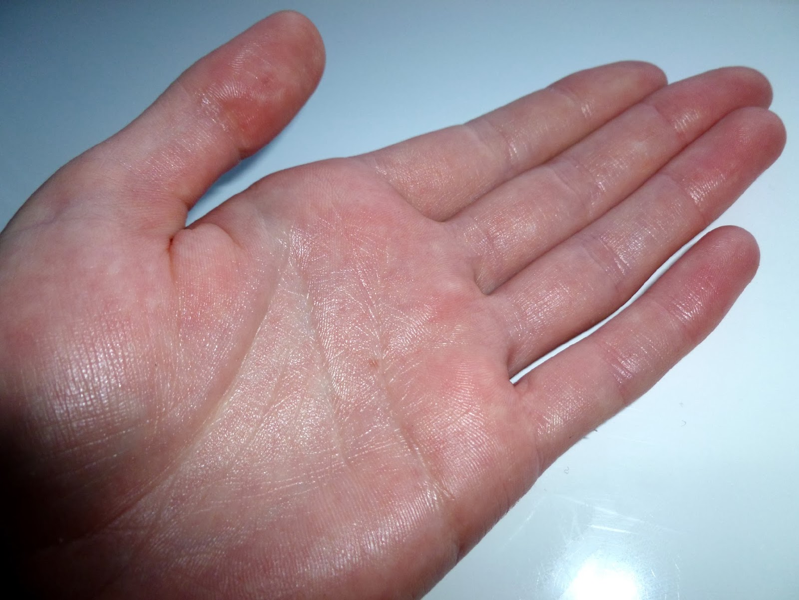 7 причин, по которым облезает кожа на руках | evolutis clinic | дзен