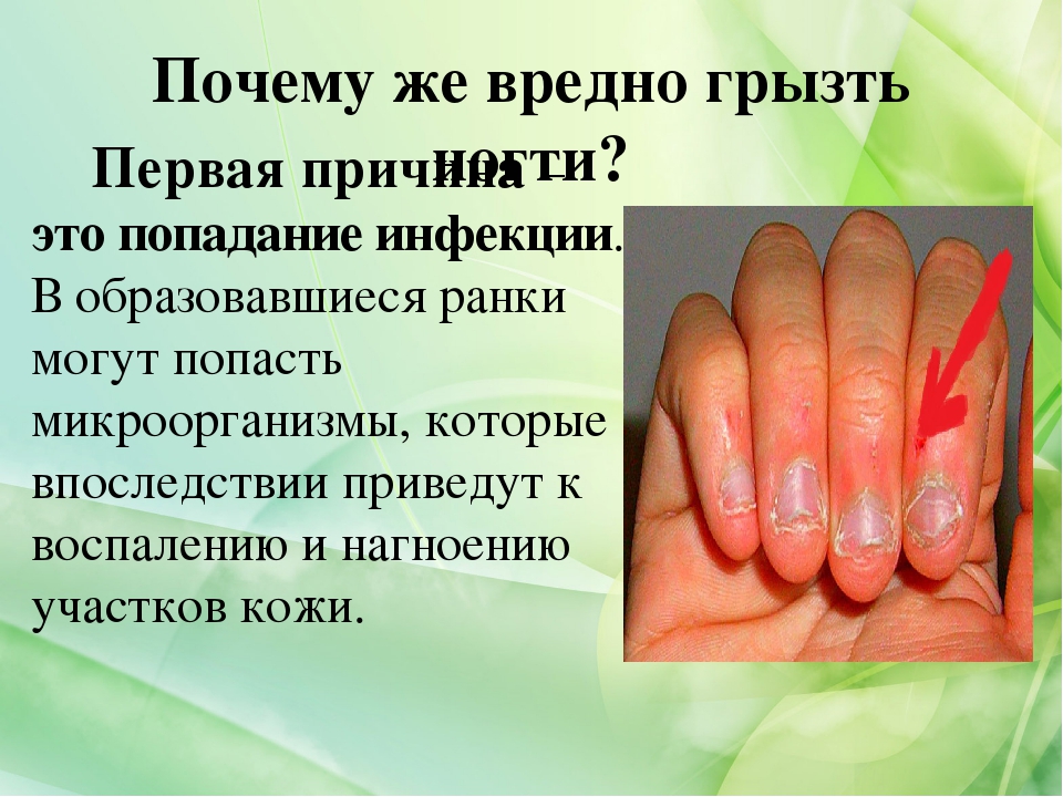 Как перестать грызть ногти девочке, мальчику, взрослому