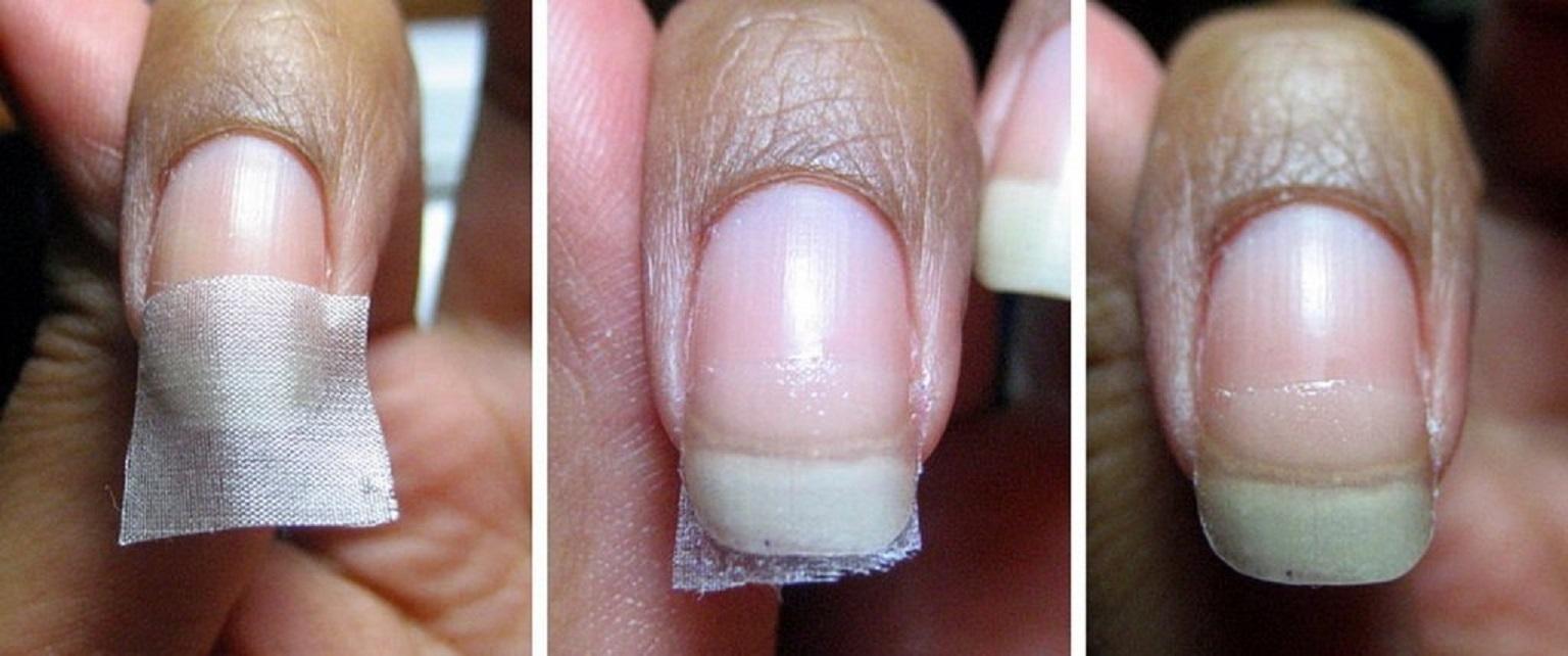Трещина на ногте: причины и методы лечения. средства для укрепления ногтей