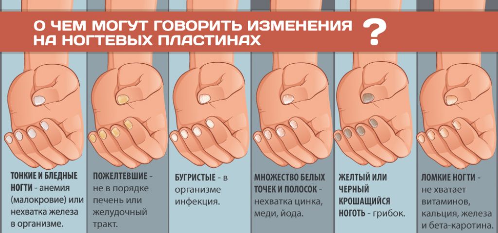 Определение болезни по ногтям на руках с фото и описанием для женщин после 50 лет