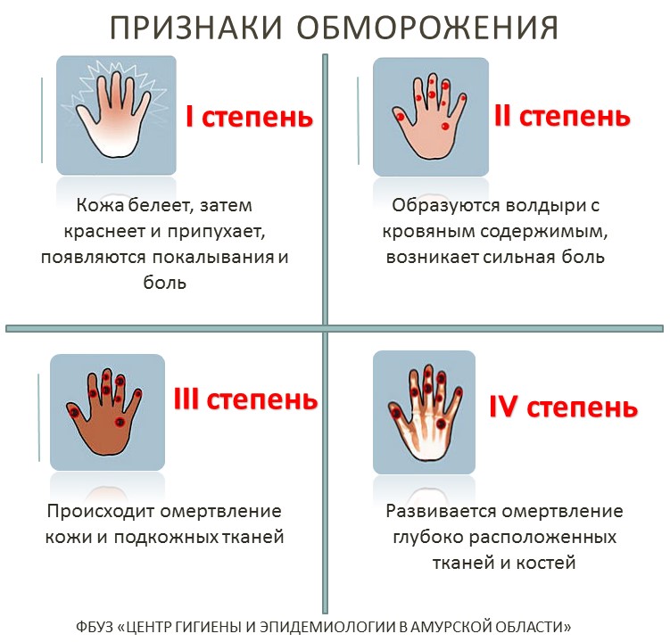 Холодные ноги: в чем причина и что с этим делать?
