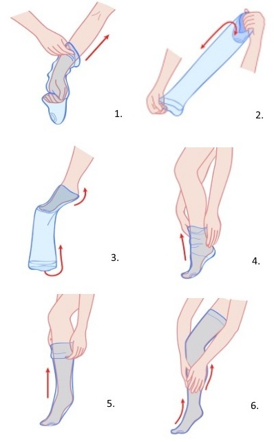Как правильно одевать компрессионные чулки при варикозе пошагово с фото для женщин