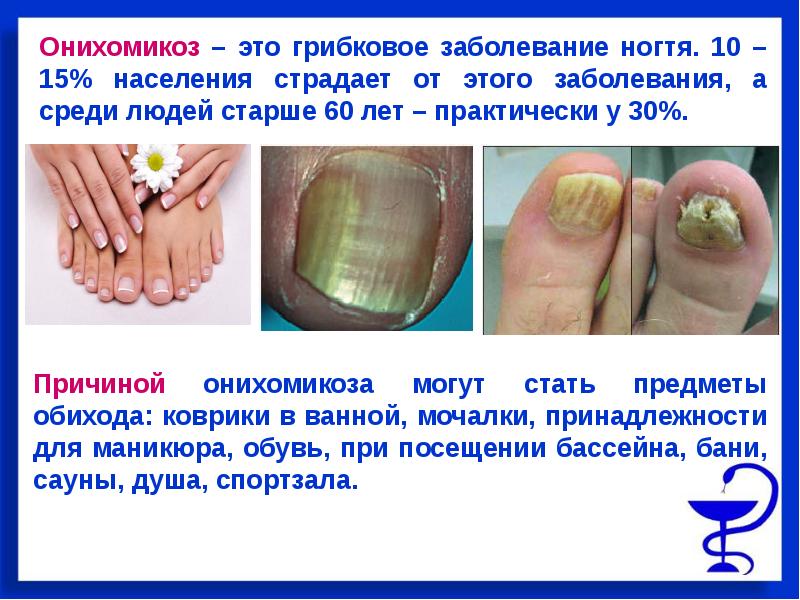 Грибок ногтей - как от него избавиться? лечение грибка ногтей.