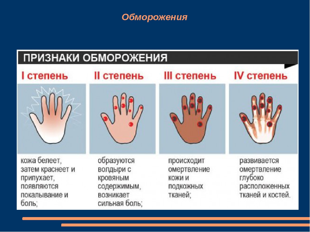 Презентация на тему первая помощь при отморожениях