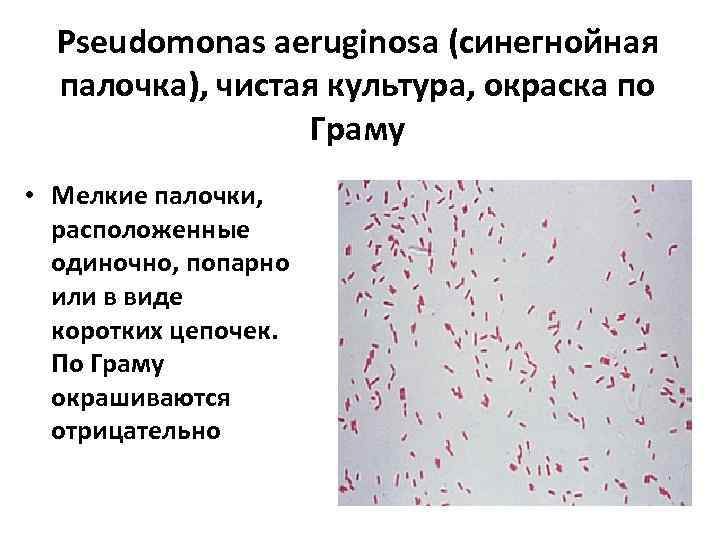 Опасна ли синегнойная палочка для ногтей? как лечить это заболевание?