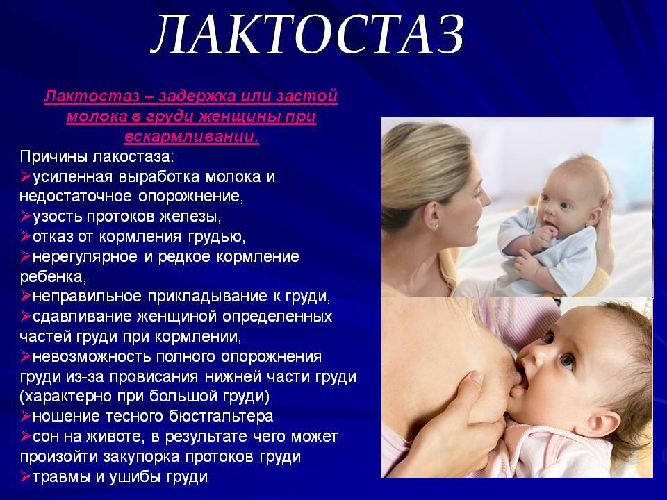 Опрелости у новорожденных детей