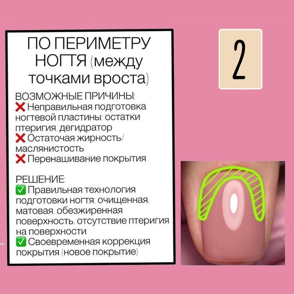 Почему гель лак быстро отслаивается от ногтя. Причины отслоек гель лака. Отслойки на ногтях гель лака причины. Причины отслойки гель лака от ногтевой пластины. Виды отслоек гель лака.