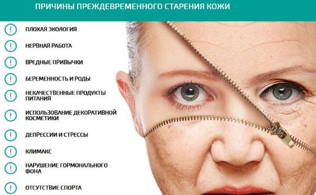 Носогубные складки