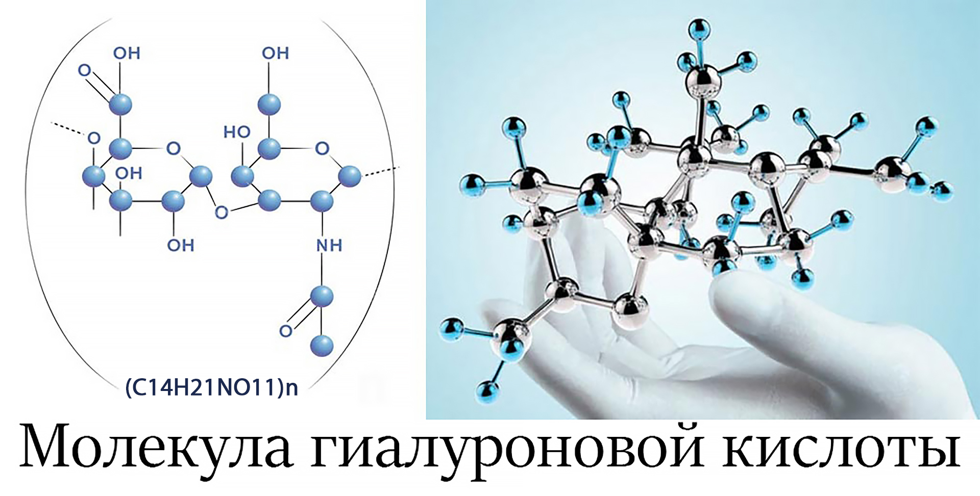 Клетки гиалуроновой кислоты