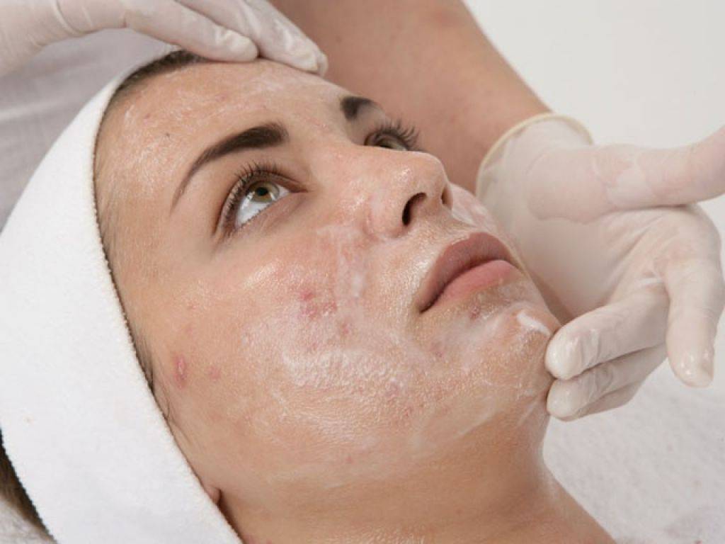 Комедогенность косметических масел | блог expert clinics