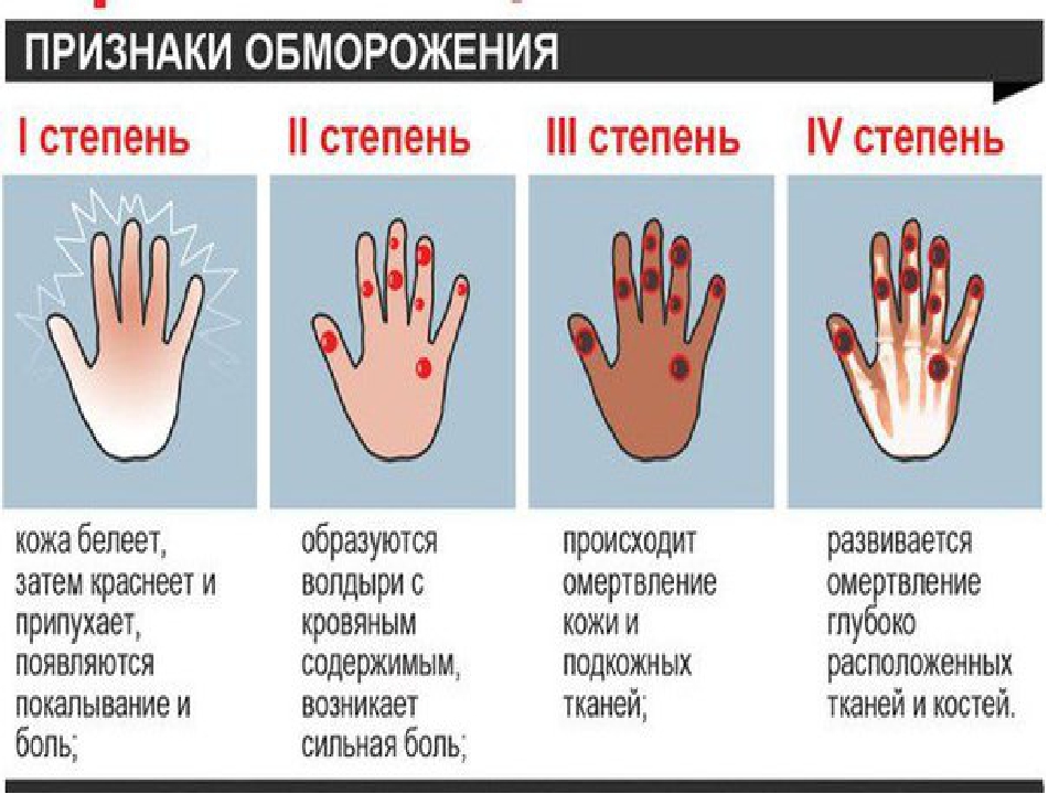 Часто девушки испытывают дискомфорт в колготках, поэтому предпочитают их не носить: 3 лайфхака, которые должны помочь