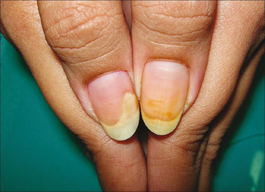 Врач по ногтям - как называется и к кому обращаться для лечения грибка