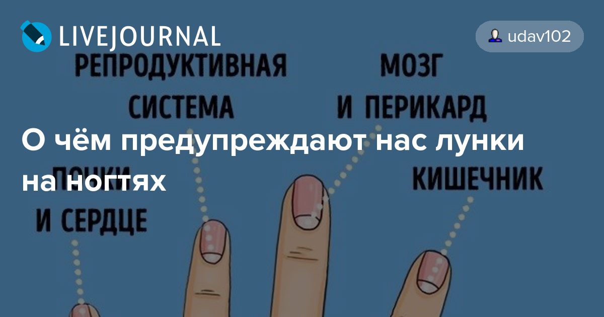 Что значат ногти. Болезни по лункам на ногтях. Отсутствуют лунки на ногтях. Лунки на ногтях значение.