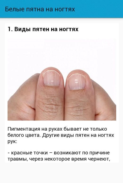 Лечение болезней и повреждений ногтей и кутикулы. о чём говорят деформации, ломкость и изменение цвета ногтей